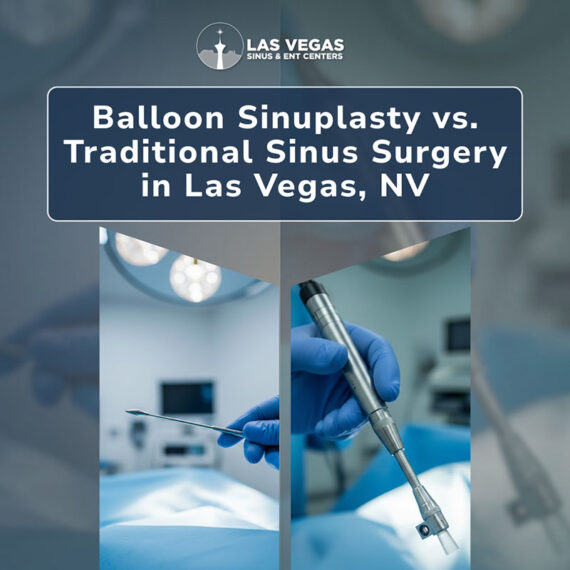 Balloon Sinuplasty vs. Traditional Sinus Surgery in Las Vegas, NV