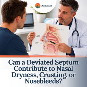 Can a Deviated Septum Contribute to Nasal Dryness, Crusting, or ...